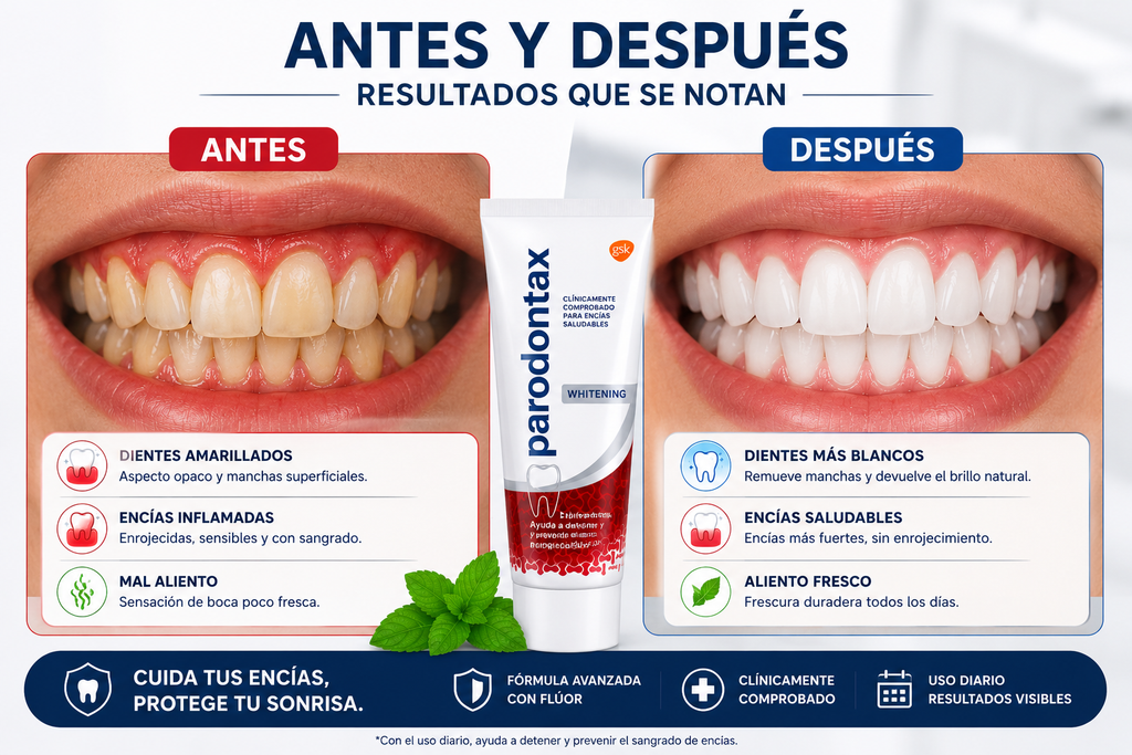Crema Dental Parodontax Whitening ayuda a cuidar tus encías, remover manchas superficiales y mantener un aliento fresco como parte de tu rutina diaria de higiene bucal.