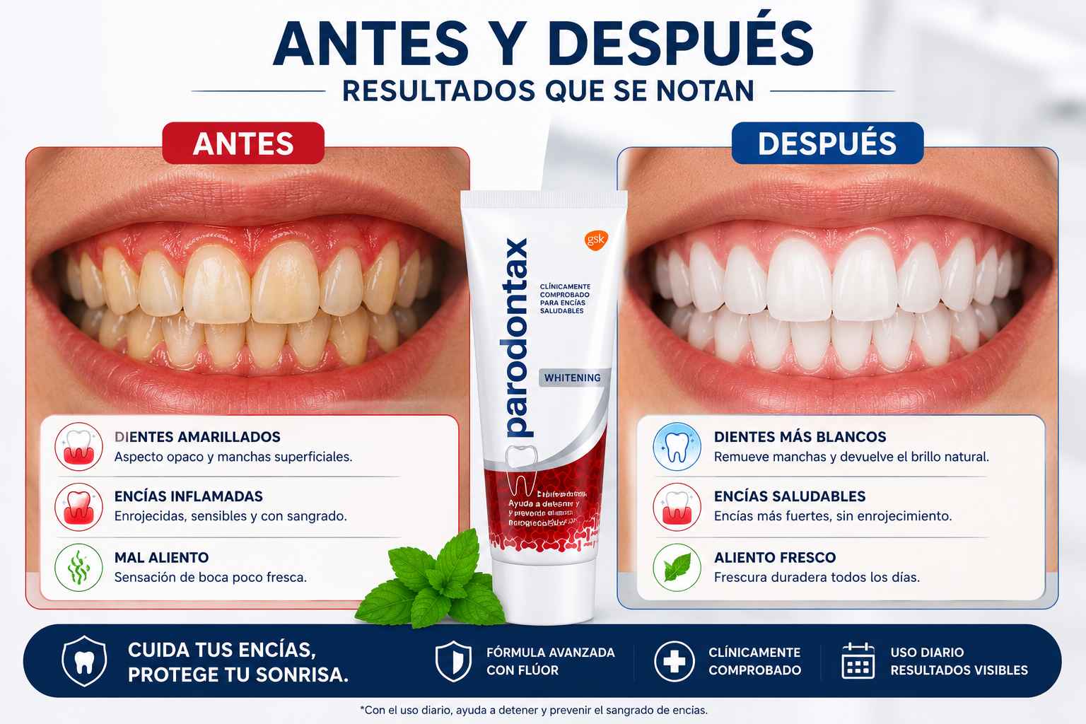 Crema Dental Parodontax Whitening ayuda a cuidar tus encías, remover manchas superficiales y mantener un aliento fresco como parte de tu rutina diaria de higiene bucal.